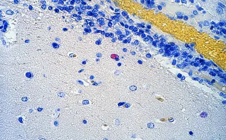 Virus Nipah Kembali Muncul, Bagaimana Cara Penularannya, Apakah Indonesia Berisiko?